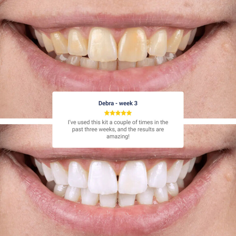 GiftyDeals image